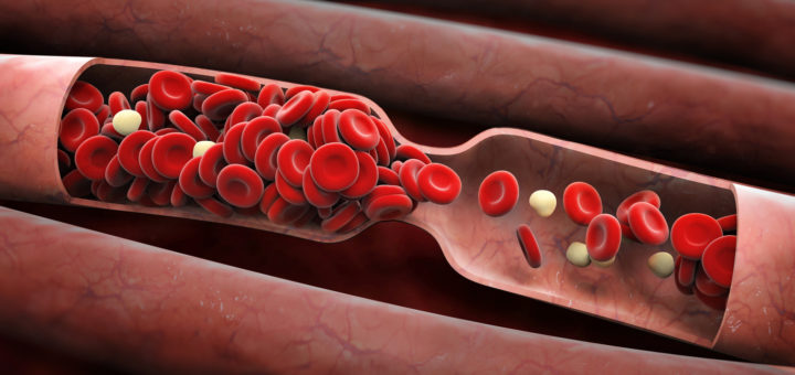 Почему густая кровь это плохо — Полезная информация